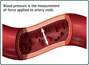 Image of artery walls