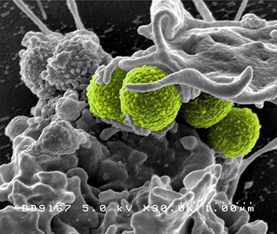 MRSA Bacteria