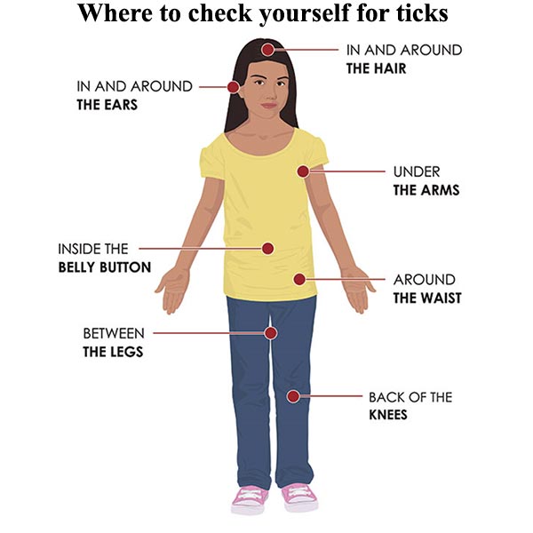 Where to check yourself for ticks