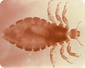 picture of a louse