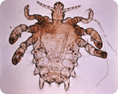 picture of a louse